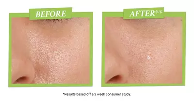 Close-up images of skin, showing a "before" on the left with visible pores and texture, and an "after" on the right with smoother, clearer skin. Text overlays indicate results from a 2-week consumer study.