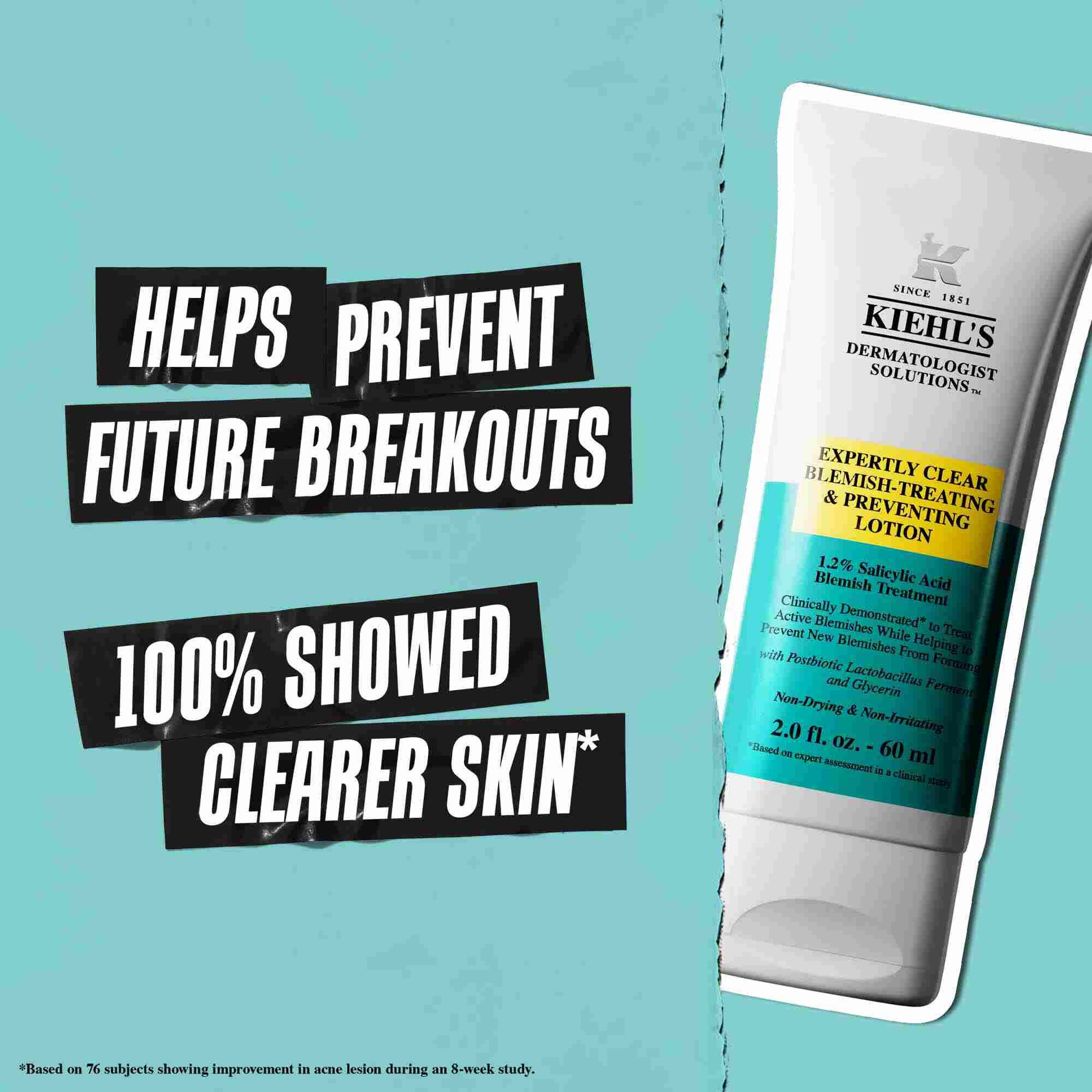En tub med Expertly Clear Blemish-Treating & Preventing Lotion mot en blå bakgrund med texten: "Hjalper till att forebygga framtida utbrott" och "100% visade renare hud."