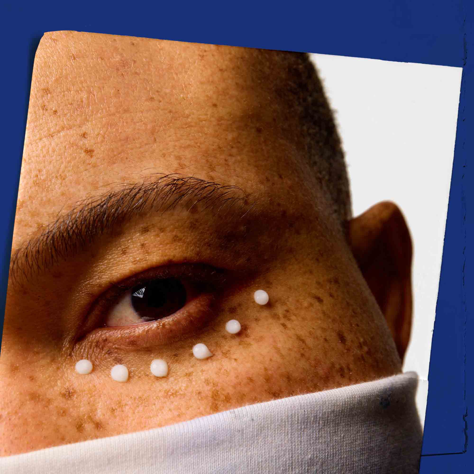 Narbild på huden runt ogonen med prickar av Facial Fuel Eye Fuel.