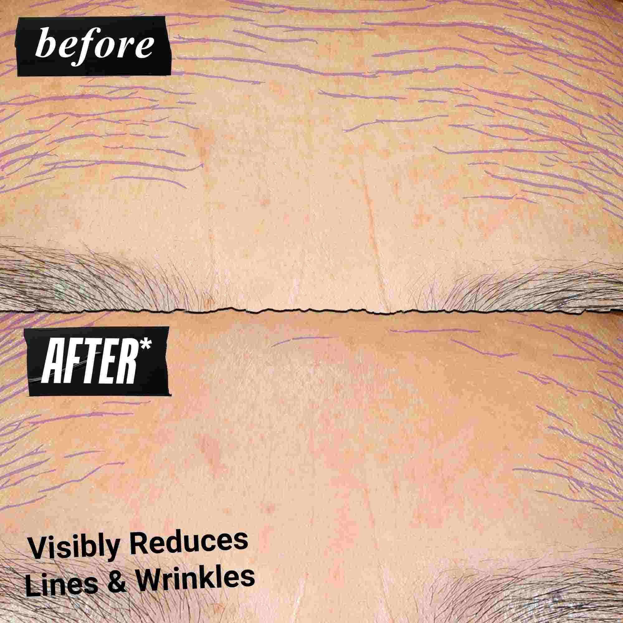 Fore- och efterbild – Kiehl's Retinol Skin Renewing Daily Microdose bidrar till att forbattra hudton och textur