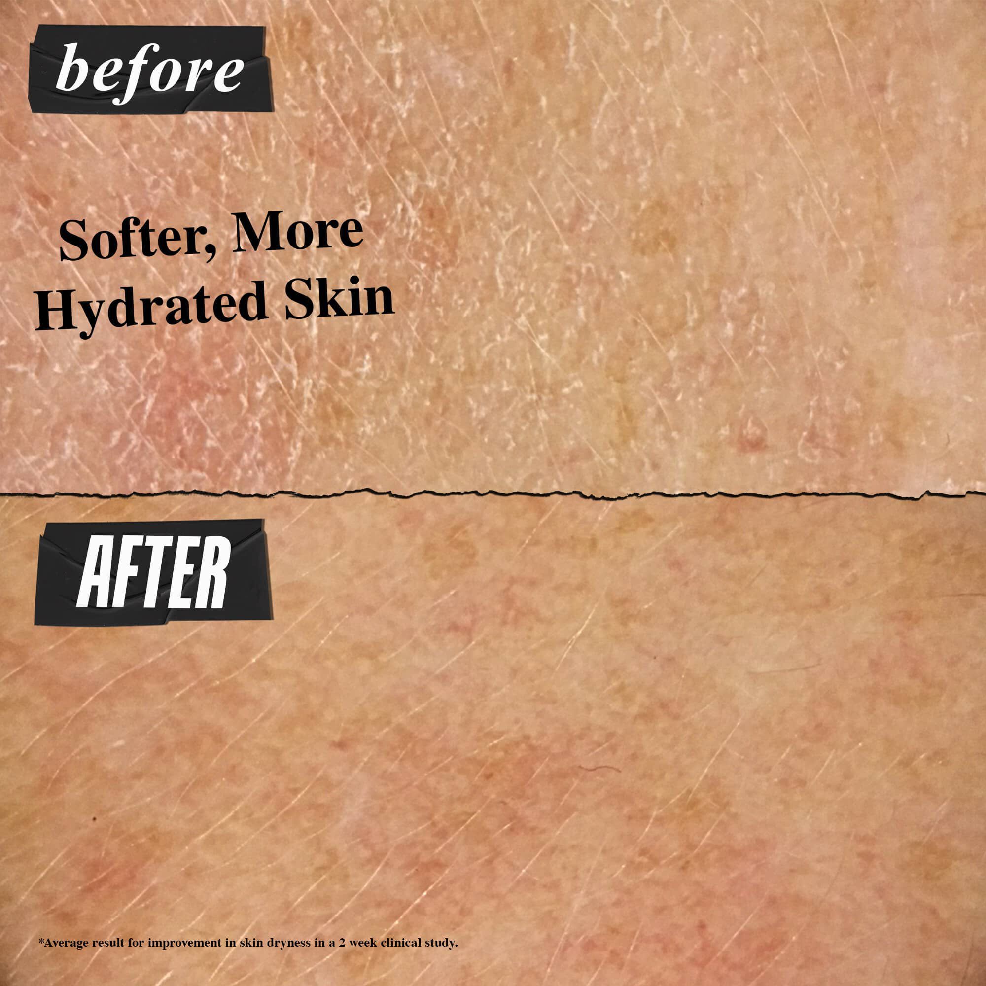 Fore- och efterbild – Ultra Facial Cream ger mjukare och mer återfuktad hy