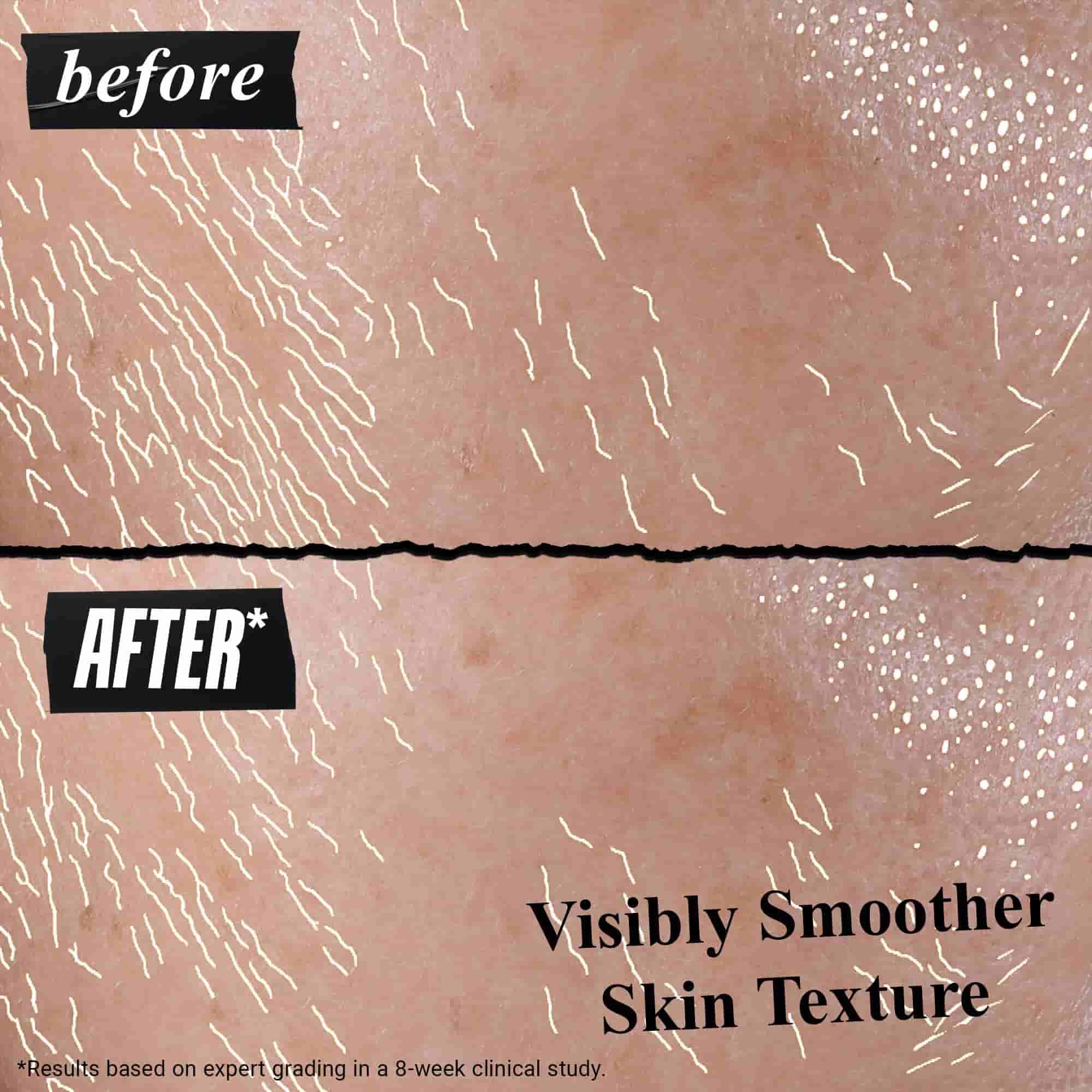 Better Screen UV Serum fore och efter resultat på huden