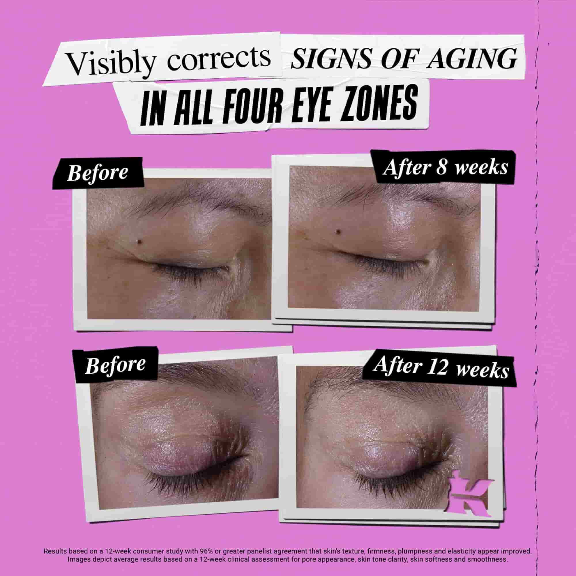 Fore- och efterbild av hur Kiehl's Super Multi-Corrective Eye Zone Treatment korrigerar ålderstecken