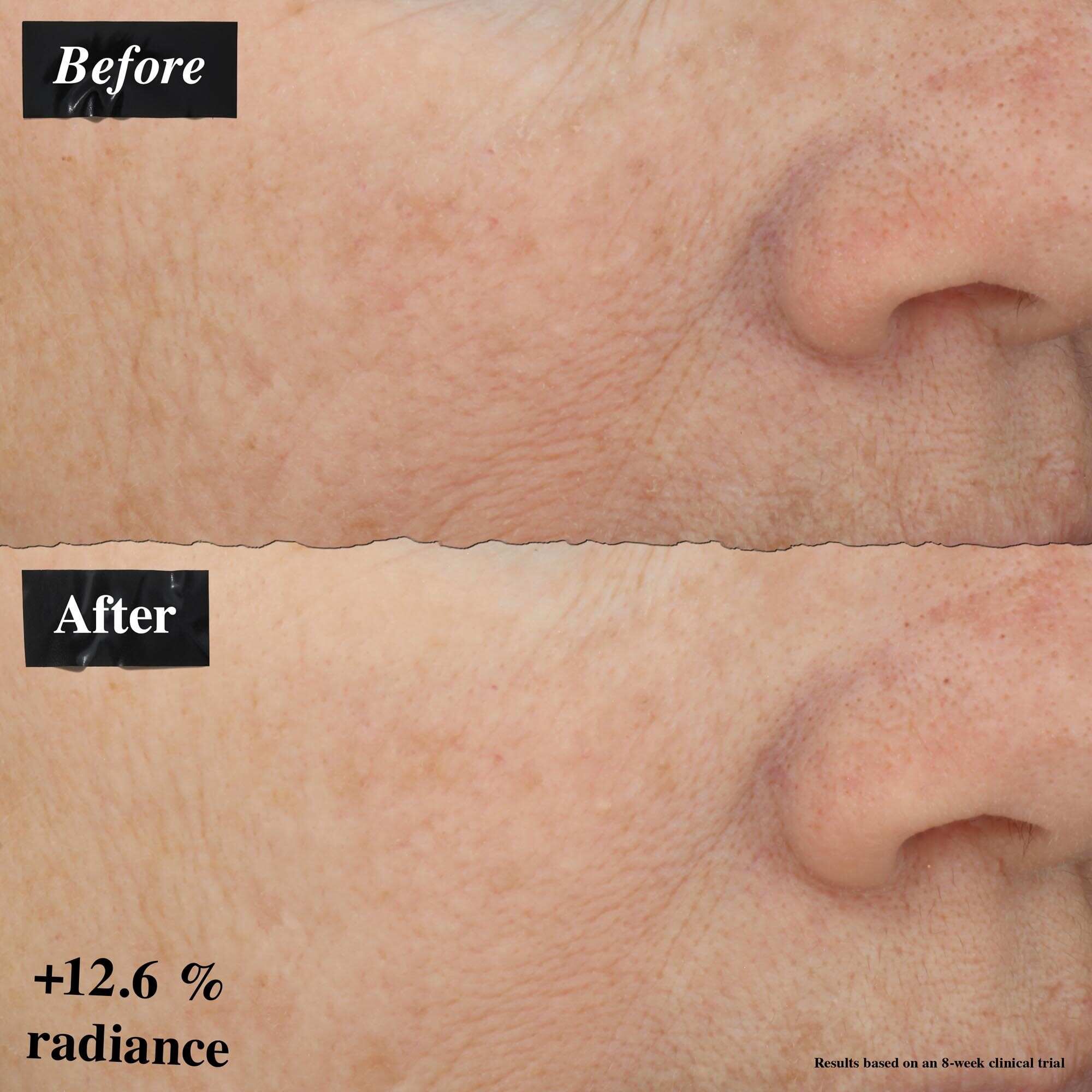 En fore-och-efter-bildjamforelse som visar forbattring av hudrodnad efter anvandning av Powerful-Strength Line-Reducing Concentrate.