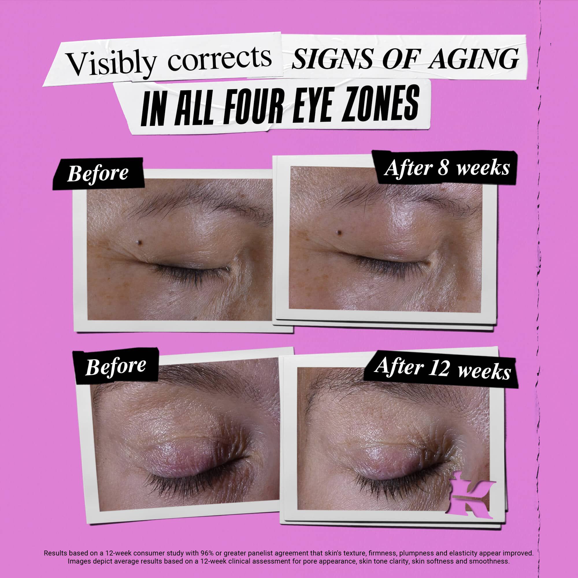 Fore- och efterbild av hur Kiehl's Super Multi-Corrective Eye Zone Treatment korrigerar ålderstecken