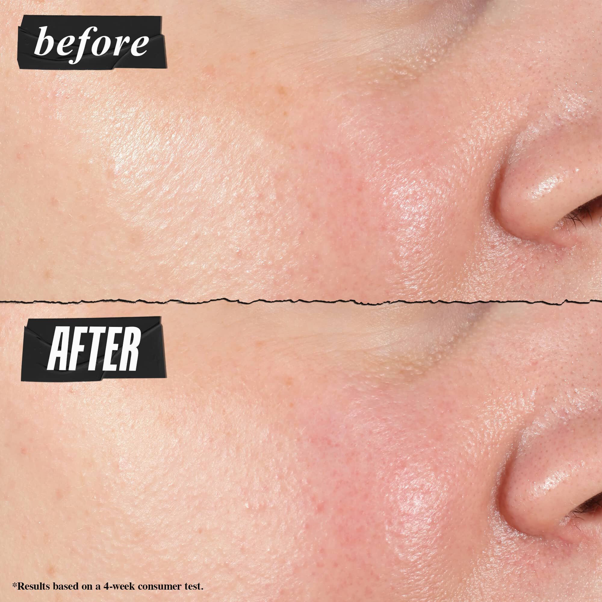 Fore- och efterbild – Kiehl's Hydro Plumping Serum Concentrate reducerar synligt porer