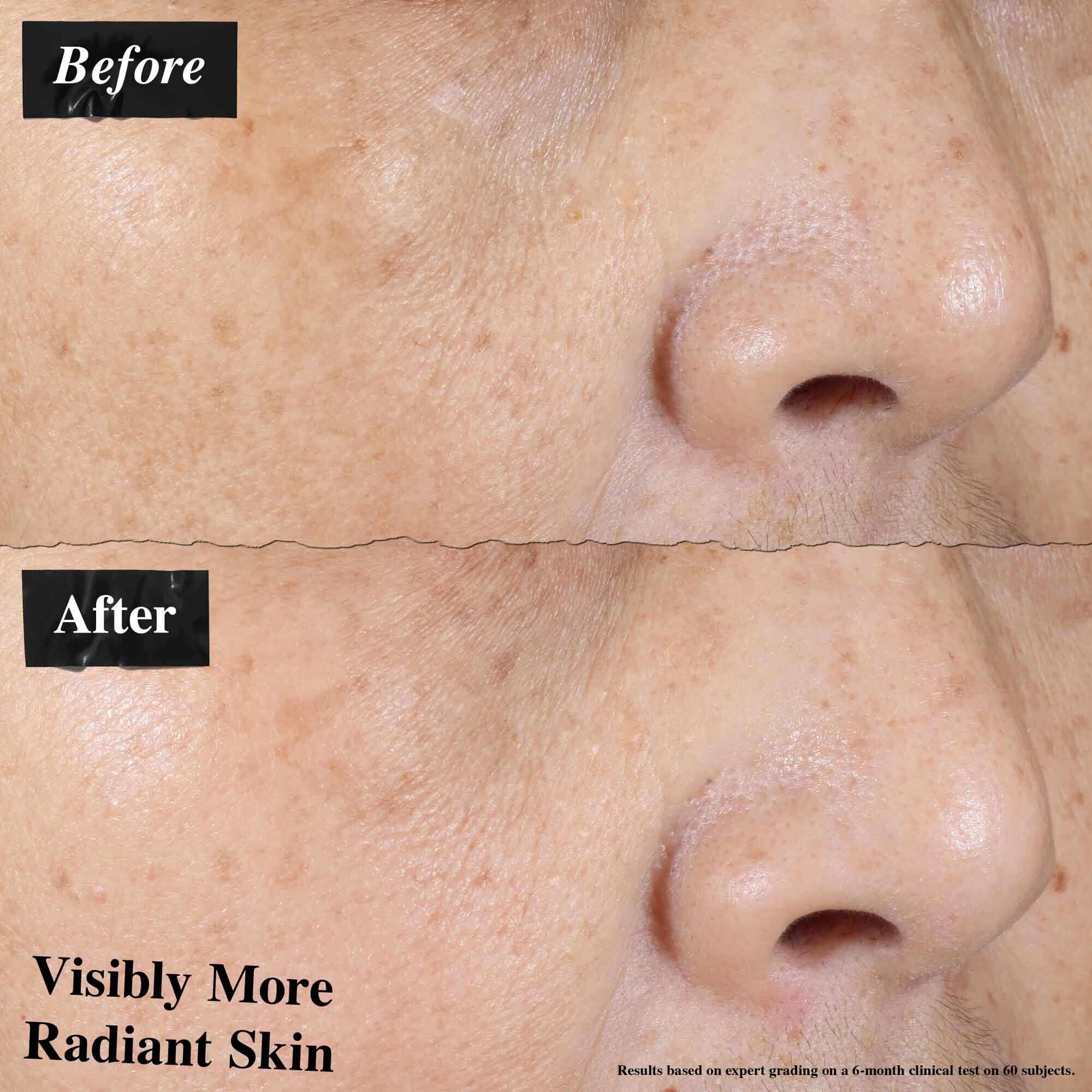 En fore-och-efter-jamforelse som visar synligt minskad hudrodnad efter anvandning av Ultra-Light Daily UV Defense.