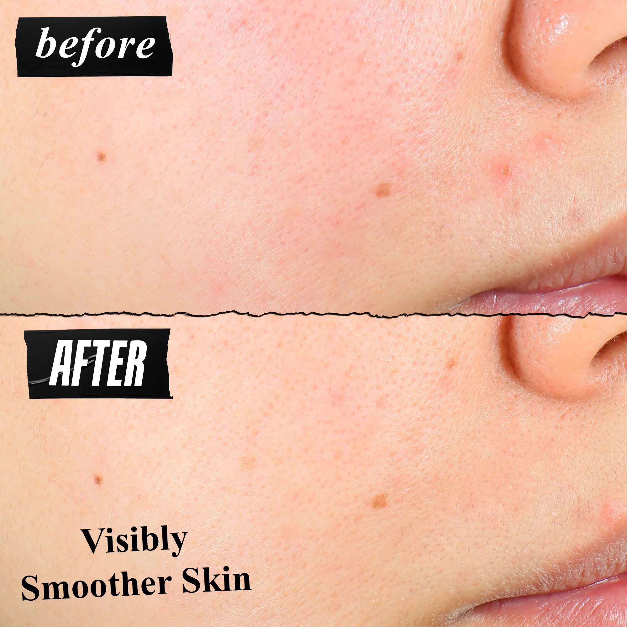 En fore-och-efter-jamforelse av hudtextur som visar synligt slatare hud efter anvandning.