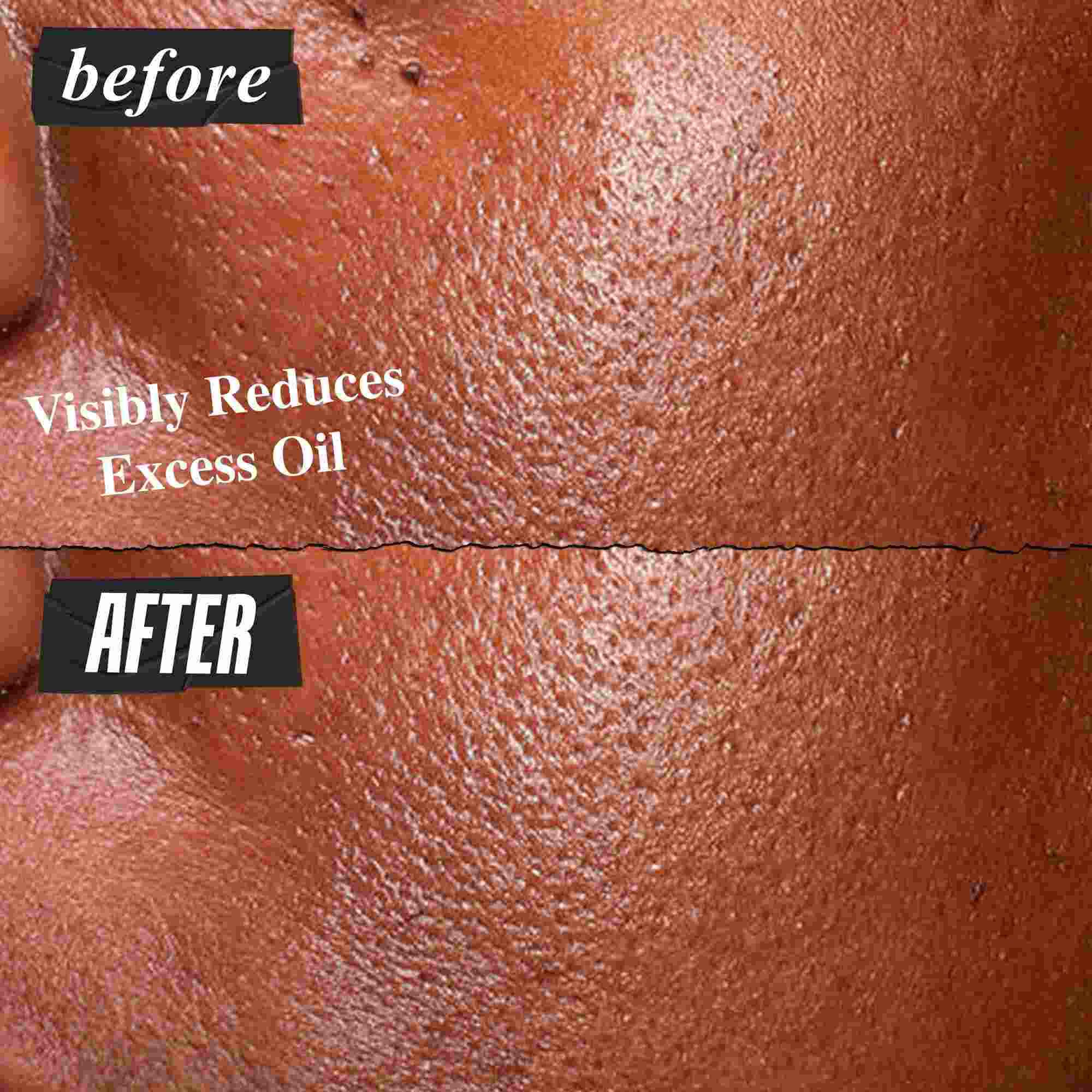 Fore- och efterbild av Kiehl's Ultra Pure High-Potency Serum som synligt reducerar overskottsolja