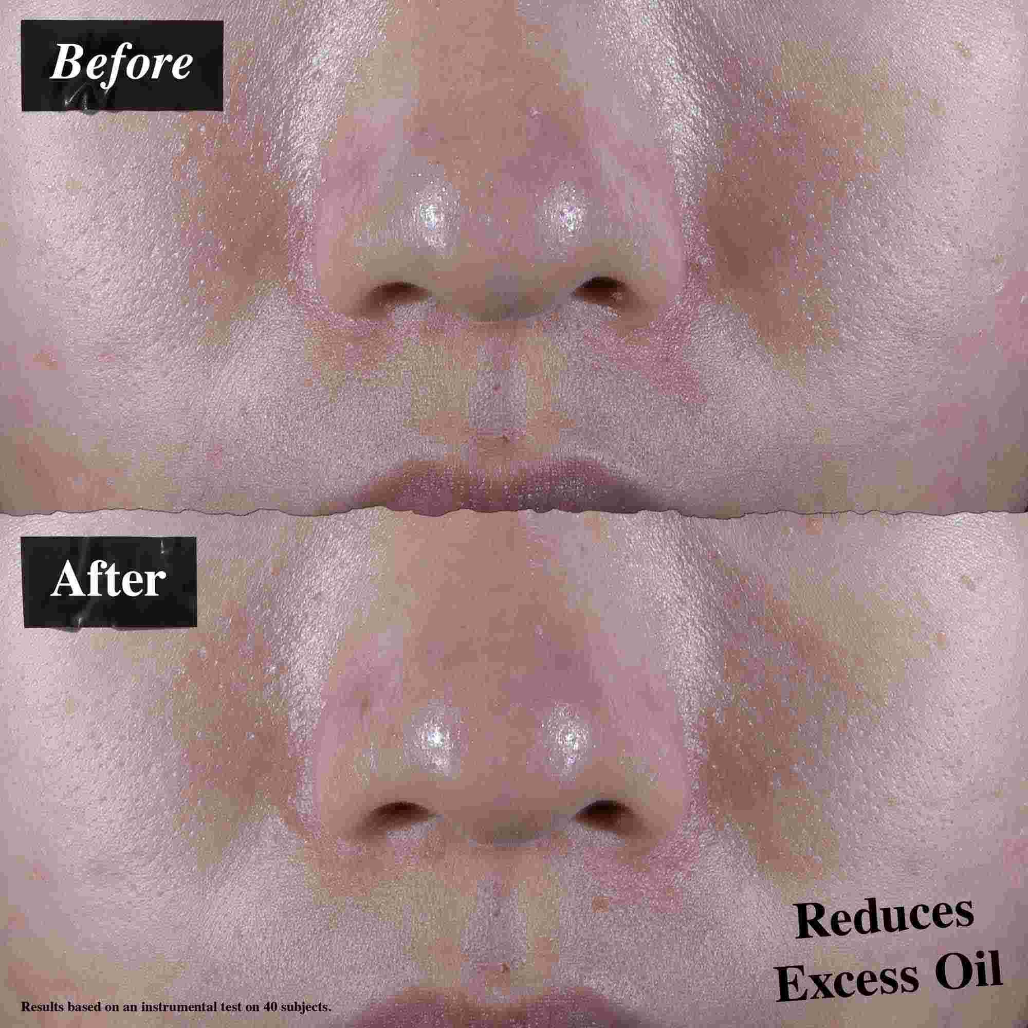 En fore-och-efter-jamforelse som visar minskad overflodig olja efter anvandning av Ultra Facial Oil-Free Gel Cream.