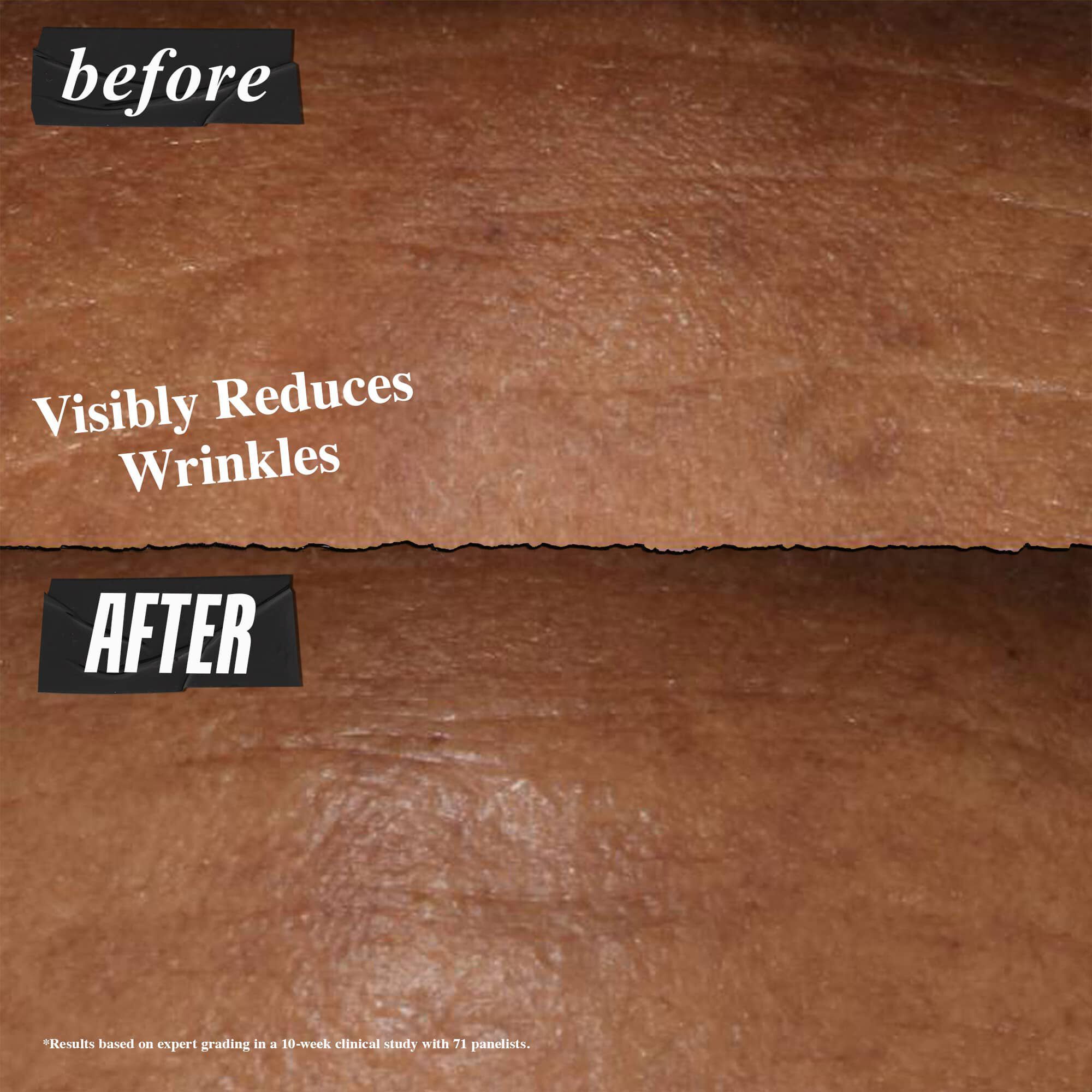 Fore- och efterbild – Kiehl's Retinol Fast Release Night Serum reducerar synligt rynkor