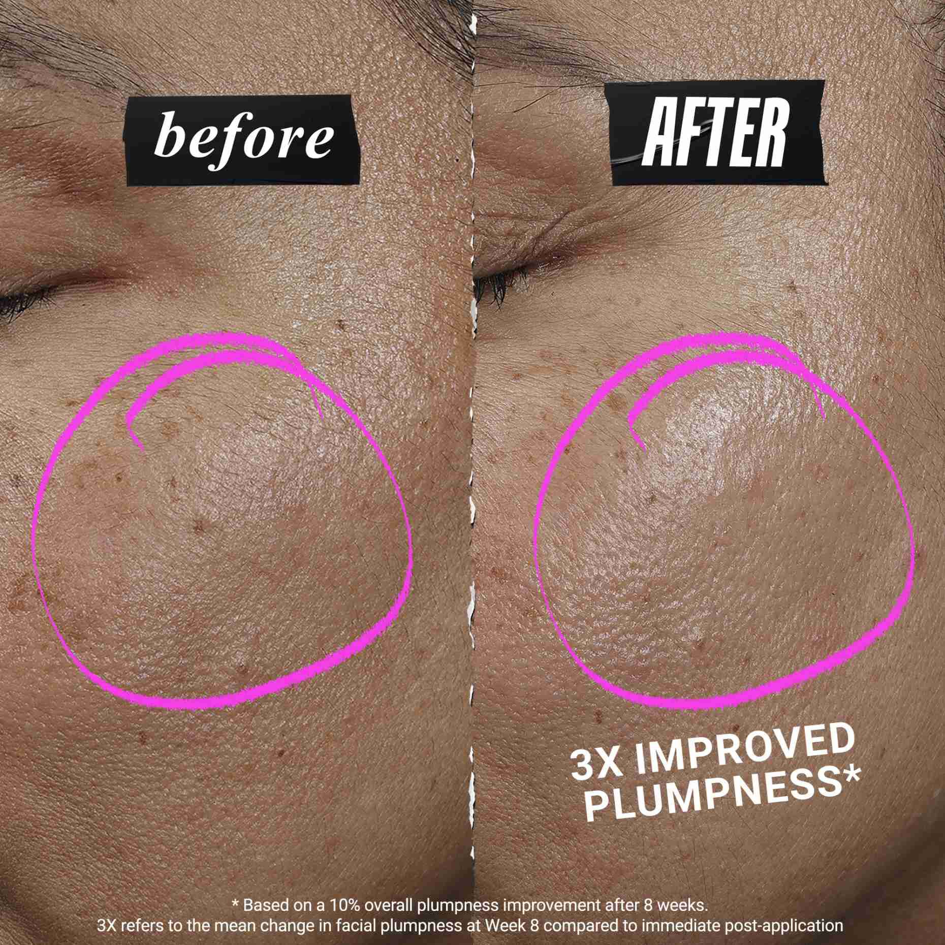 1cc* CollaShot Plump Serum, Collagen Face Serum for lyft, fylligare hud